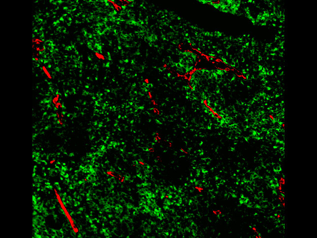 TA99: Confocal microscopy of a cryosection of B16F10 melanoma tumor and associated vascular endothelium, 10x magnification (green: Trp1 Alexa Fluor 488; red: CD31 PE). By Courtney Diamond/Gregory Szeto