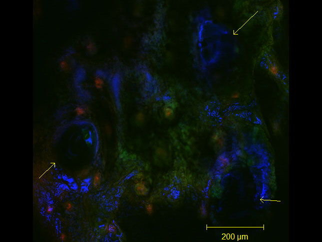 Delivery of sucrose/virus-tipped microneedles into the ears of transgenic mice. Yellow arrows indicate microneedle penetration pits/points. color key--blue: sucrose MN tips (Alexa Fluor 647), red: wild-type cells (tdTomato), green: virus infected cells/gene recombination (EGFP);  taken at 10X. By Lauren M Adelaar, Gregory L Szeto