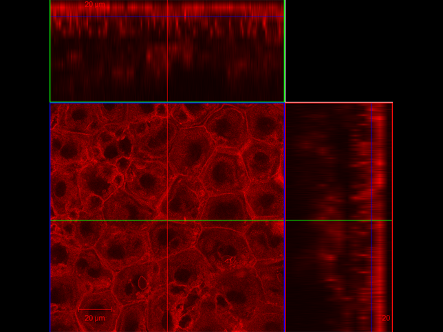 LMA2: Suprabasal layer within the epidermis of mtmg mouse ear (taken at 63x). red: tdTomato beta-actin. By Lauren M Adelaar, Gregory L Szeto