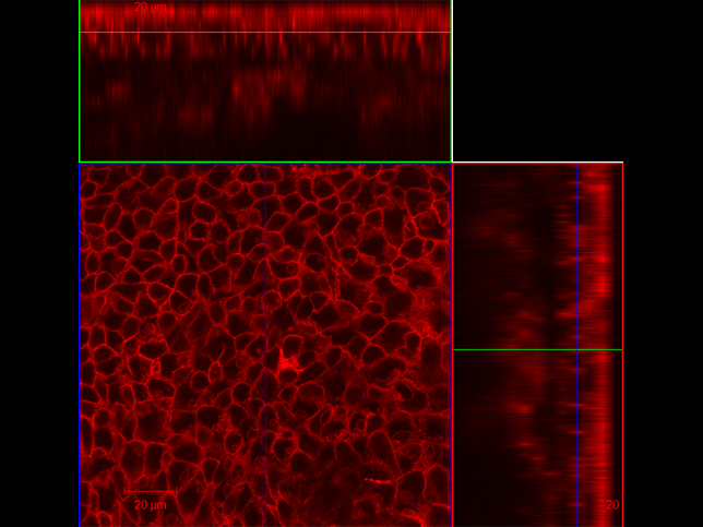 LMA3: Keratinocytes in epidermis of mtmg mouse (taken at 63x). red: tdTomato beta-actin. By Lauren M Adelaar, Gregory L Szeto