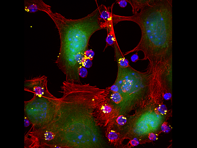 Lethal encounter.The image indicates robustness of immunosurveillance, where fewer T cells are able to find the tumor cells and form conjugates- the first and key step towards a killing event. This image is a larger view showing many T cell-tumor cell conjugate formation events occurring simultaneously. B16F10 tumor cell (green, CFSE) T cells (blue, DAPI); nanopartilces (yellow, DiD); phalloidin, Alexa568.Entry is 60X. Image by Sudha Kumari/Yiran Zheng.   